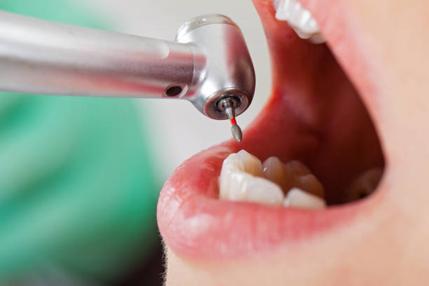 Best Pediatric Emergency Dentist in Energy, IL